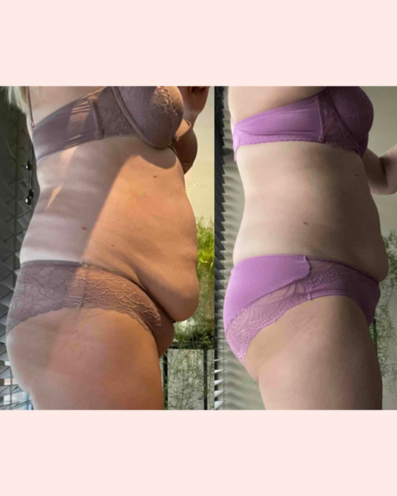Transformation 2